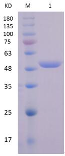 15% SDS-PAGE analysis profiles of purified PA5133-20-428 (CBB stained).